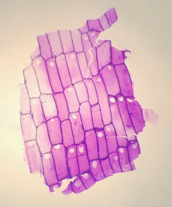 Sphagnum russowii